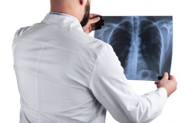 Doktor röntgeni inceliyor.