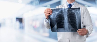 x-ışını insan beyninin tutan doktor