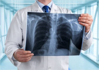 x-ışını insan beyninin tutan doktor