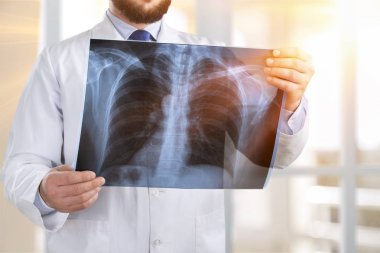 Doktor Röntgen, yakından görmek incelenmesi 