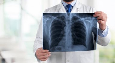 Doktor Röntgen yakından görmek incelenmesi 