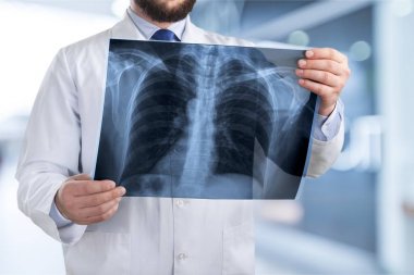Doktor röntgende arka plan bulanık incelenmesi 