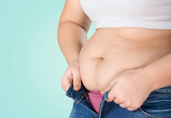 Žena s tuku břicho — Stock fotografie