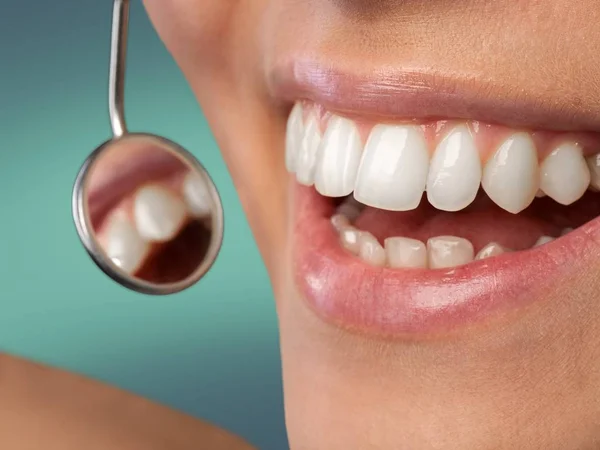 女性の歯と歯医者の口鏡 — ストック写真