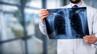 Erkek doktor holding x-ray