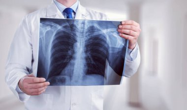 Doktor, röntgene bakın..