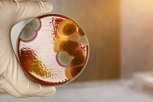 human hand holding petri dish
