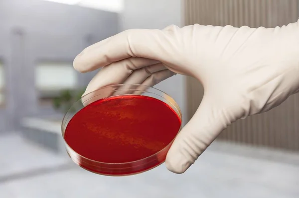 Wissenschaftler Halten Petrischale Mit Bakterien Der Hand — Stockfoto