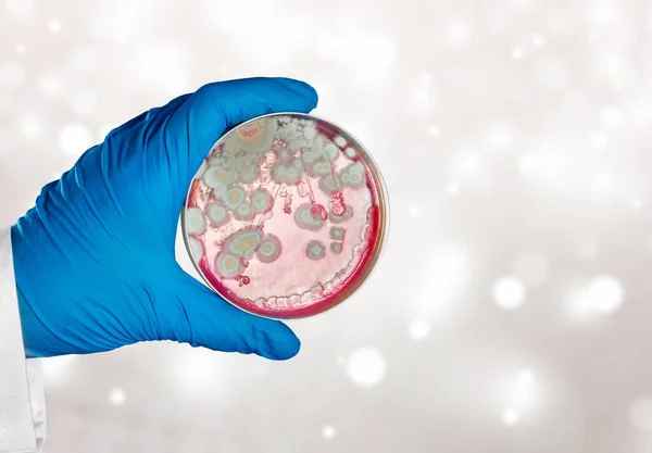 Mano Los Científicos Sosteniendo Petri Plato Con Bacterias — Foto de Stock