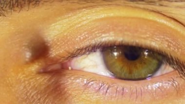 Uykulu göz yanıp söner