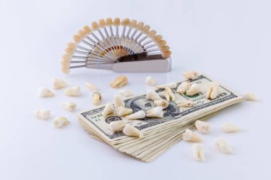 Diş kerascop Kerascop seramik diş ve beyaz arka plan üzerinde hospitalas masada dolar sürüsü ile.