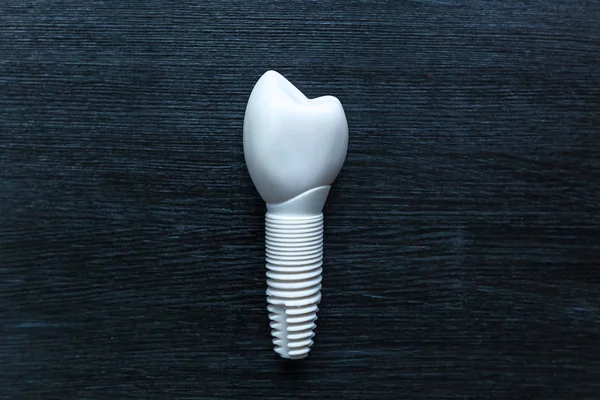 Tooth prosthesis. — Stock Photo, Image