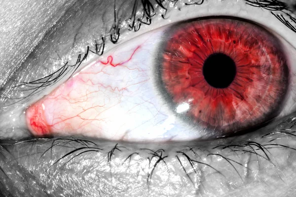 Mänskliga ögat med röda snäva vener på protein makro närbild textur bakgrund — Stockfoto