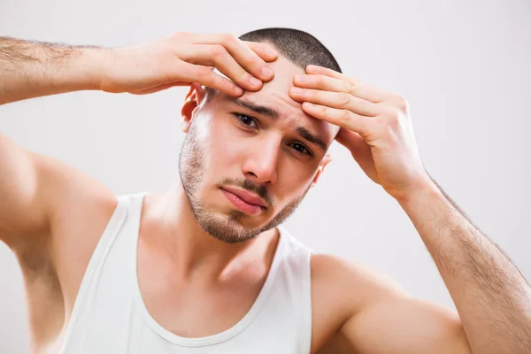 Joven Hombre Está Apretando Espinilla Frente — Foto de Stock