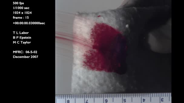 Laboratório Crime Forense Estuda Esfregaço Sanguíneo Movimento Lento Causado Pelo — Vídeo de Stock