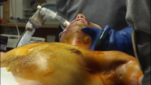 アフガニスタンでの戦闘中に胸を撃たれた兵士は緊急手術を受ける — ストック動画