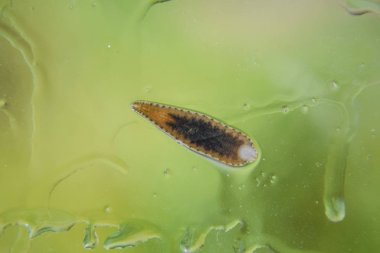 Cama sülük. Kan emici hayvan. Kemer-türü sınıfından ringworms alt sınıfı. Hirudotherapy.