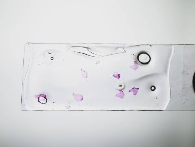 Tümör cam altında dilim. Kanser varlığı için tümör hücrelerinin histolojik inceleme