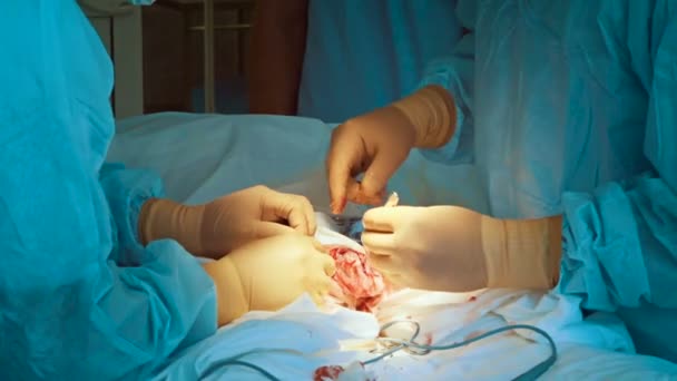 Takım çalışma cerrahi eldiven eller yukarı kapatın — Stok video