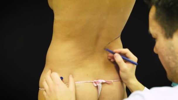 Mujer de edad avanzada gruesa se prepara para la liposucción médica. El doctor dibuja un marcador, marca en el abdomen. El cirujano dibuja el marcado antes de la operación por liposucción en el paciente a la mujer — Vídeo de stock