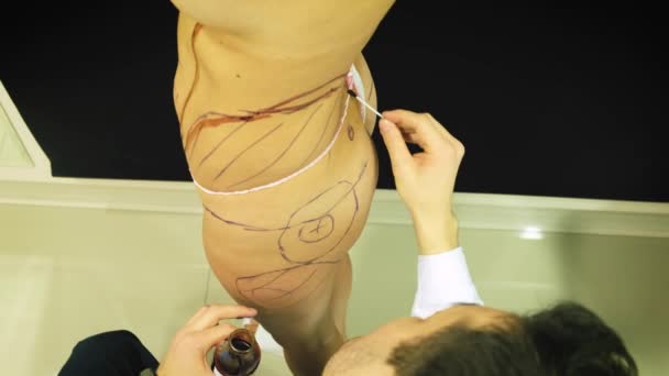 Thick elderly woman prepares to medical liposuction. Doctor draws marker, mark on the abdomen. The surgeon draws the markup before the operation by liposuction on the patient to the woman — Stock Video