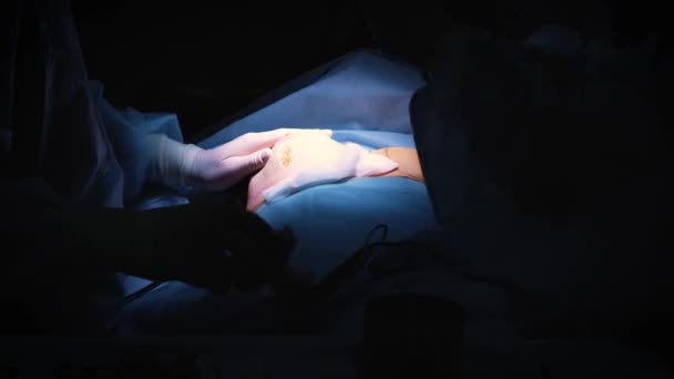 Введение имплантата в грудь пациента во время пластической операции по увеличению груди. Хирург вставляет под кожу силиконовый имплантат женской груди. Увеличивает сиськи — стоковое видео