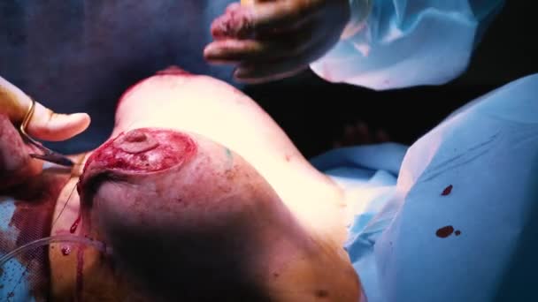 breast augmentation surgery video Cheap jelly dildo