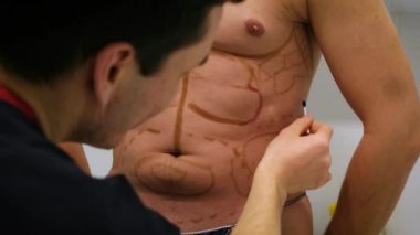 Bir plastik cerrah liposuction ve liposculpture işlemi için bir biçimlendirme çizer. Bir hasta bir adamdır, bir güzellik mans