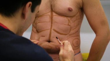 Bir plastik cerrah liposuction ve liposculpture işlemi için bir biçimlendirme çizer. Bir hasta bir adamdır, bir güzellik mans