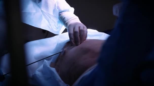 The doctor performs an operation of liposuction to a man. Gathers the fat of the cannula. Cosmetic surgery for a man, improvement of his body. — Stock Video