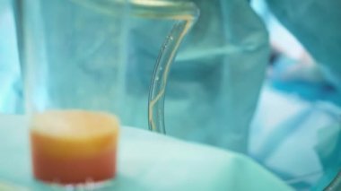 yağ ve yağ aldırma ameliyatı şişman Arayıcı. insan yağı liposuction sonra cam. Ameliyat sırasında fazla kalori drenaj