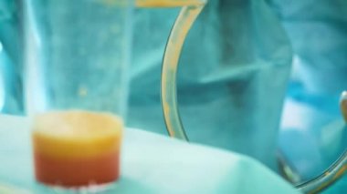 yağ ve yağ aldırma ameliyatı şişman Arayıcı. insan yağı liposuction sonra cam. Ameliyat sırasında fazla kalori drenaj