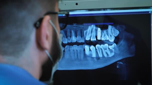 Стоматолог изучает рентгеновское 3D изображение челюсти — стоковое видео