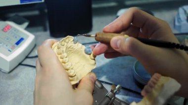 Diş hekimi çenesine takma diş takıyor. Dişçi elinde bir çene implantı tutuyor ve malzemeyi aletlerle uyguluyor. Modern dişçilik teknolojileri. Yakın plan, 4k..