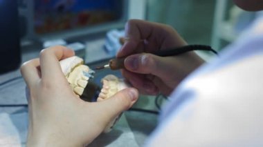 Diş hekimi çenesine takma diş takıyor. Dişçi elinde bir çene implantı tutuyor ve malzemeyi aletlerle uyguluyor. Modern dişçilik teknolojileri. Yakın plan, 4k..