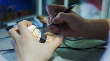 Diş hekimi çenesine takma diş takıyor. Dişçi elinde bir çene implantı tutuyor ve malzemeyi aletlerle uyguluyor. Modern dişçilik teknolojileri. Yakın plan, 4k..