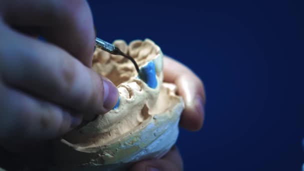 O dentista faz uma dentadura no maxilar. O dentista segura um implante mandibular em suas mãos e aplica o material com ferramentas. Tecnologias modernas em odontologia. Close-up, 4K . — Vídeo de Stock