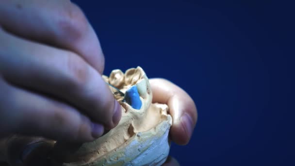 El médico dentista hace una prótesis en la mandíbula. El dentista sostiene un implante de mandíbula en sus manos y aplica el material con herramientas. Tecnologías modernas en odontología. Primer plano, 4k . — Vídeos de Stock