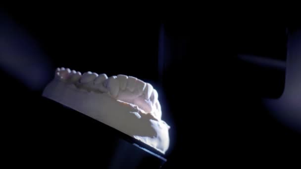 Stomatologické protetické restaurování. Denturist dělá 3d modelu pro tvarované plastové chrup s high-tech digitální skenování zařízení. 3D zub skenování — Stock video