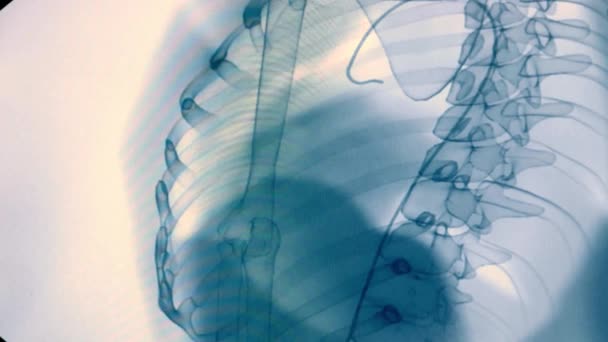 Imagen en blanco y negro de la angiografía de los vasos sanguíneos del cuerpo humano. Chequeo médico y examen. Problemas del corazón y los vasos sanguíneos en el cuerpo. Control por rayos X de los vasos sanguíneos — Vídeos de Stock