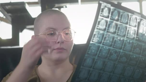 Portret van een blanke vrouw ziek van kanker, verzoek om hulp, sociale bescherming. Een kaal meisje met kanker of leukemie onderzoekt een MRI-scan of röntgenfoto. De vrouw onderging chemotherapie. — Stockvideo