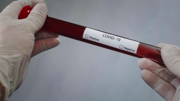 바이러스학자는 코로나 바이러스에 감염 된 혈액 샘플이 들어 있는 시험관을 들고 있다. 혈액내 의 COVID-19 바이러스 테스트. 실험실에서의 세균학 무기 연구. 유행병 SARS-CoV-2 — 비디오