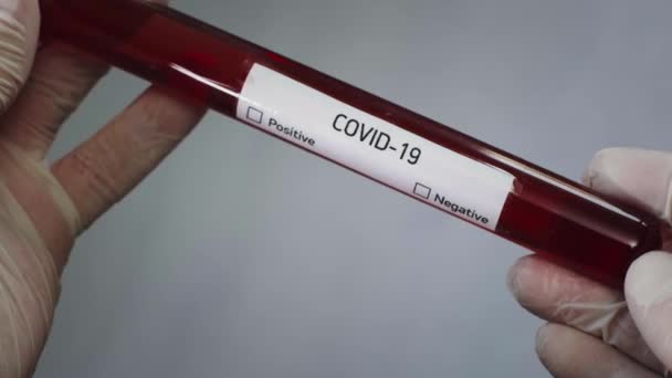 Le virologiste tient une éprouvette avec un échantillon de sang infecté par un coronovirus. Test de dépistage du virus COVID-19 dans le sang. Études en laboratoire d'armes bactériologiques. CoV-SRAS pandémique 2 — Video