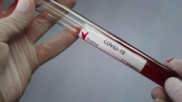 Ο ιολόγος κρατάει ένα δοκιμαστικό σωλήνα με ένα δείγμα αίματος μολυσμένο με έναν κορωνοϊό. Σημειώνει θετικά αποτελέσματα. Εξέταση για τον ιό COVID-19 στο αίμα. Εργαστηριακές μελέτες βακτηριολογικών όπλων — Αρχείο Βίντεο