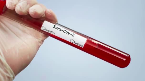 The virologist is holding a test tube with a blood sample infected with a coronovirus. Notes positive results. Test for COVID-19 virus in the blood. Laboratory studies of bacteriological weapons — Stock Video