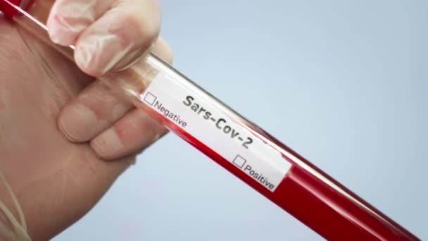 Ο ιολόγος κρατάει ένα δοκιμαστικό σωλήνα με ένα δείγμα αίματος μολυσμένο με έναν κορωνοϊό. Σημειώνει αρνητικά αποτελέσματα. Εξέταση για τον ιό COVID-19 στο αίμα. Εργαστηριακές μελέτες βακτηριολογικών όπλων — Αρχείο Βίντεο