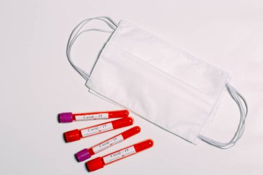 Coronavirus aşısı. Test tüplerinde Coronavirus için pozitif kan testleri