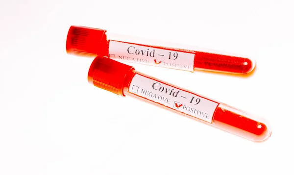 Exames Sanguíneos Positivos Para Coronavirus Tubos Ensaio — Fotografia de Stock