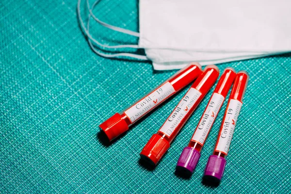 Coronavirus Aşısı Test Tüplerinde Coronavirus Için Pozitif Kan Testleri — Stok fotoğraf