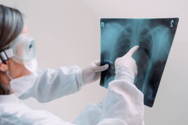 Beyaz arka planda duran doktorlar klinikteki Covid-19 hastasının zatürresi için röntgen çekiyorlar. Coronavirus konsepti